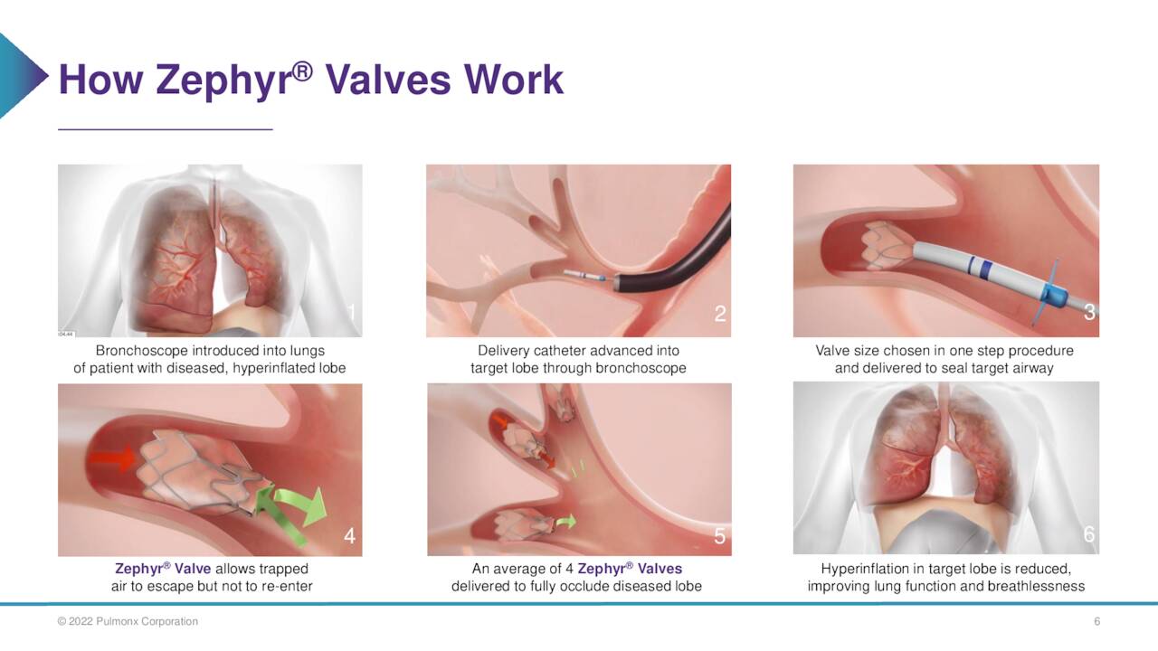 How Zephyr Valves Work ®